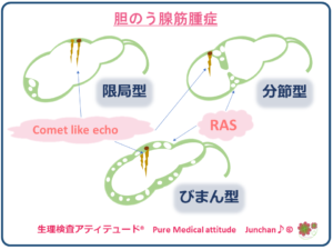 胆嚢 ポリープ 消える